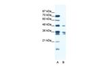 ZNF577 Antibody in Western Blot (WB)