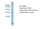 RECQL5 Antibody in Western Blot (WB)