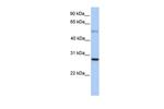 MXD1 Antibody in Western Blot (WB)