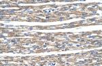 DLX5 Antibody in Immunohistochemistry (IHC)