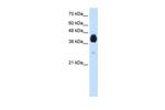 DLX5 Antibody in Western Blot (WB)