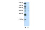 PLAGL1 Antibody in Western Blot (WB)