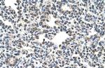 CIZ1 Antibody in Immunohistochemistry (IHC)