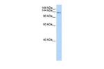 CIZ1 Antibody in Western Blot (WB)