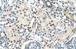 AKAP8L Antibody in Immunohistochemistry (IHC)