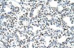 AKAP8L Antibody in Immunohistochemistry (IHC)