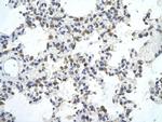 ZNF444 Antibody in Immunohistochemistry (Paraffin) (IHC (P))