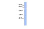 CBLL1 Antibody in Western Blot (WB)