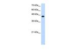 TFAP2E Antibody in Western Blot (WB)