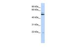 PRMT2 Antibody in Western Blot (WB)