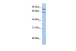 PPP1R10 Antibody in Western Blot (WB)