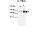 hnRNP UL1 Antibody in Western Blot (WB)