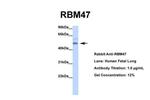 RBM47 Antibody in Western Blot (WB)