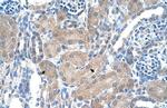 SLA/LP Antibody in Immunohistochemistry (Paraffin) (IHC (P))