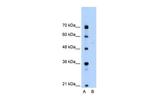 SLA/LP Antibody in Western Blot (WB)