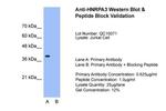 hnRNP A3 Antibody in Western Blot (WB)