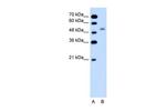 NKCC2 Antibody in Western Blot (WB)