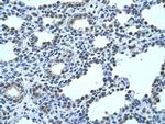 FBP1 Antibody in Immunohistochemistry (Paraffin) (IHC (P))