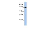 STS Antibody in Western Blot (WB)