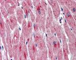 DMPK Antibody in Immunohistochemistry (IHC)