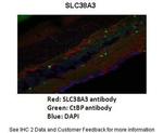 SLC38A3 Antibody in Immunohistochemistry (IHC)