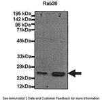 RAB38 Antibody in Western Blot (WB)