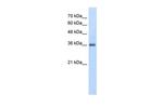 PPAP2A Antibody in Western Blot (WB)