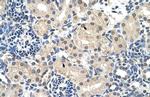 C14orf130 Antibody in Immunohistochemistry (IHC)