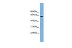 OATP1 Antibody in Western Blot (WB)