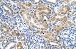 SLC22A3 Antibody in Immunohistochemistry (IHC)