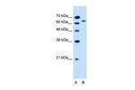 SLC22A3 Antibody in Western Blot (WB)
