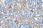 SLC36A3 Antibody in Immunohistochemistry (IHC)