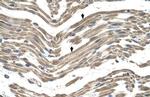 C1QB Antibody in Immunohistochemistry (IHC)