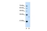 C1QB Antibody in Western Blot (WB)