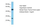 CLEC2D Antibody in Western Blot (WB)