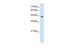 CTH Antibody in Western Blot (WB)