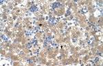 PEX3 Antibody in Immunohistochemistry (IHC)