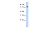 RMI1 Antibody in Western Blot (WB)