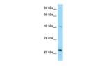 MMP20 Antibody in Western Blot (WB)