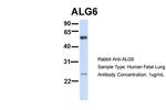 ALG6 Antibody in Western Blot (WB)