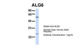 ALG6 Antibody in Western Blot (WB)