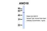 TMEM16K Antibody in Western Blot (WB)