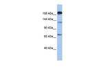 MTR Antibody in Western Blot (WB)