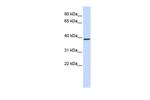 QPCT Antibody in Western Blot (WB)