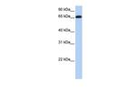 ENTPD7 Antibody in Western Blot (WB)