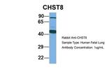 CHST8 Antibody in Western Blot (WB)