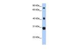 FIBCD1 Antibody in Western Blot (WB)