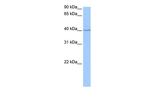 SP6 Antibody in Western Blot (WB)