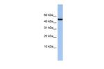 ABAT Antibody in Western Blot (WB)