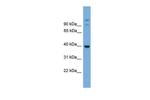 SUGT1 Antibody in Western Blot (WB)